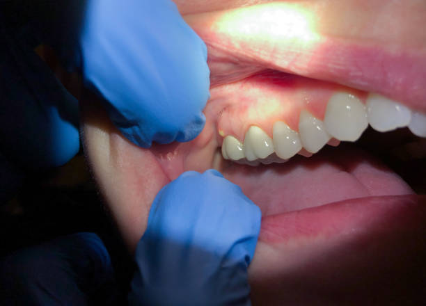 Best Emergency Treatment for Jaw Pain or Injury in Chesterland, OH
